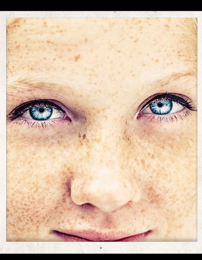 Comme masquer les taches de pigment sur le cou de la photo
